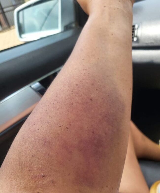 Six Free State caregivers charged with assaulting 81-year-old