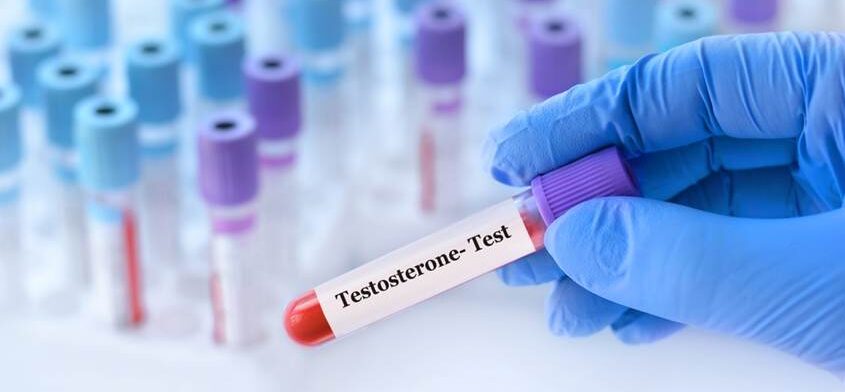 There is more to testosterone than age