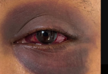 Outcry over GBV incident pushes police to act