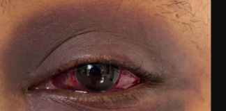 Outcry over GBV incident pushes police to act