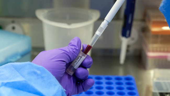 Uganda sends medical teams to DRC to support ebola fight