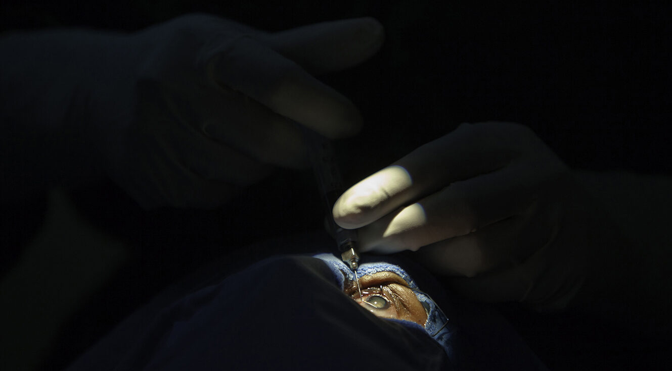 South Africa needs a coordinated national plan for cataract-surgery training